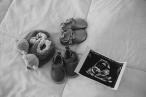 Baby shoes, plush toys, and an ultrasound photo arranged on white bedding.