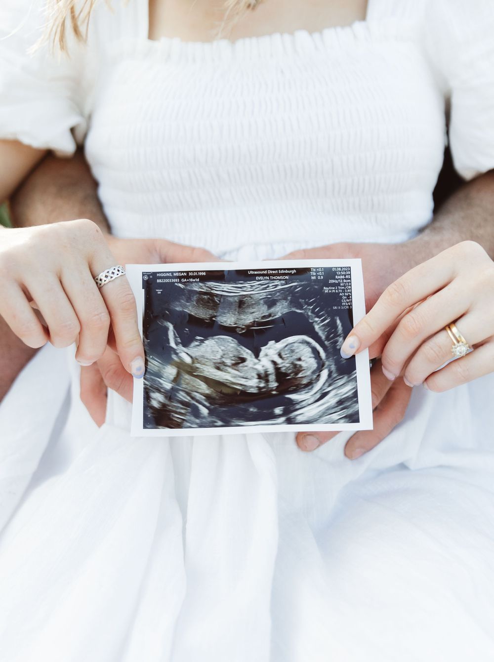 Series of ultrasound photos displayed on white fabric background.
