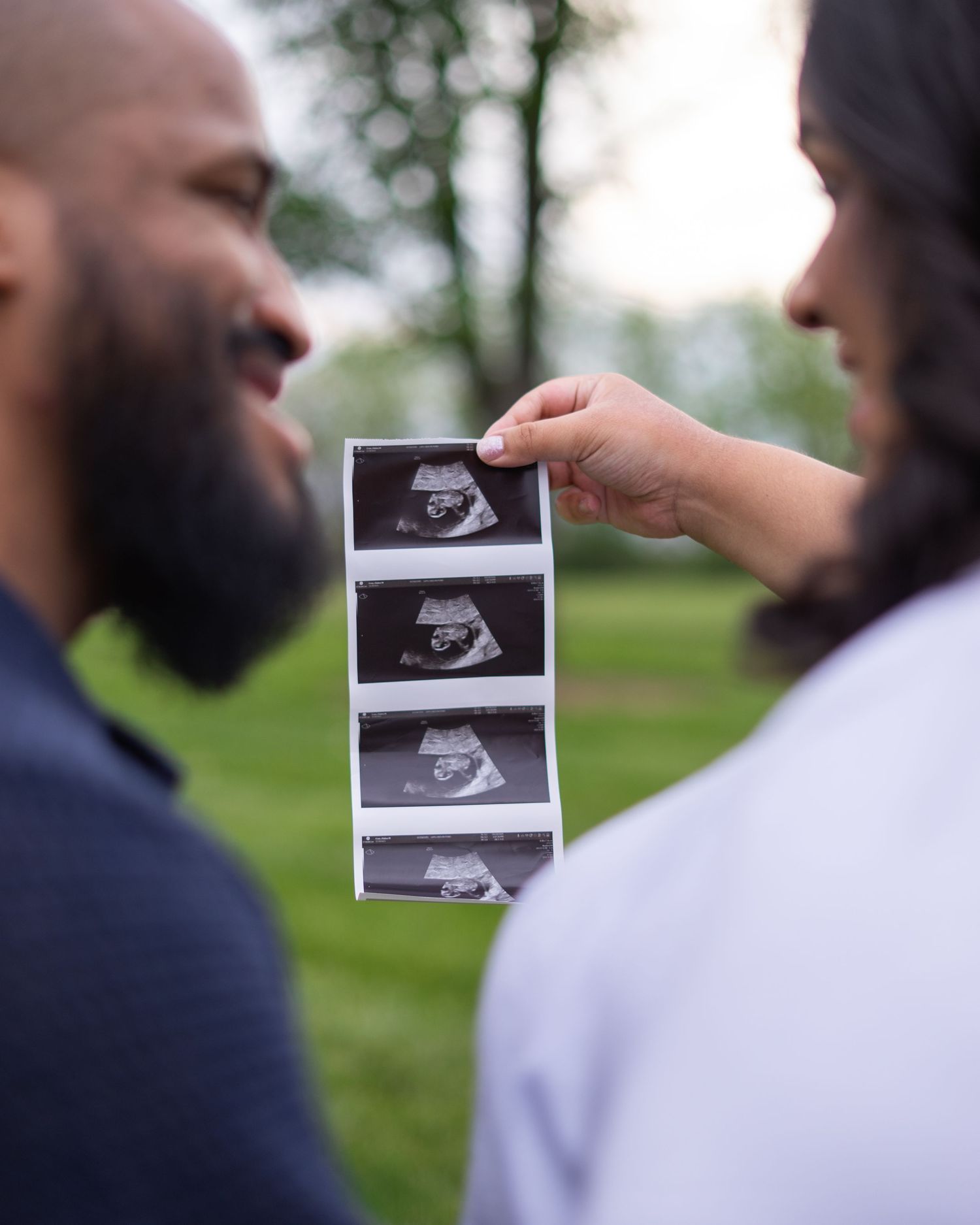 Couple holding ultrasound sonogram photos outdoors, pregnancy announcement in a park setting.