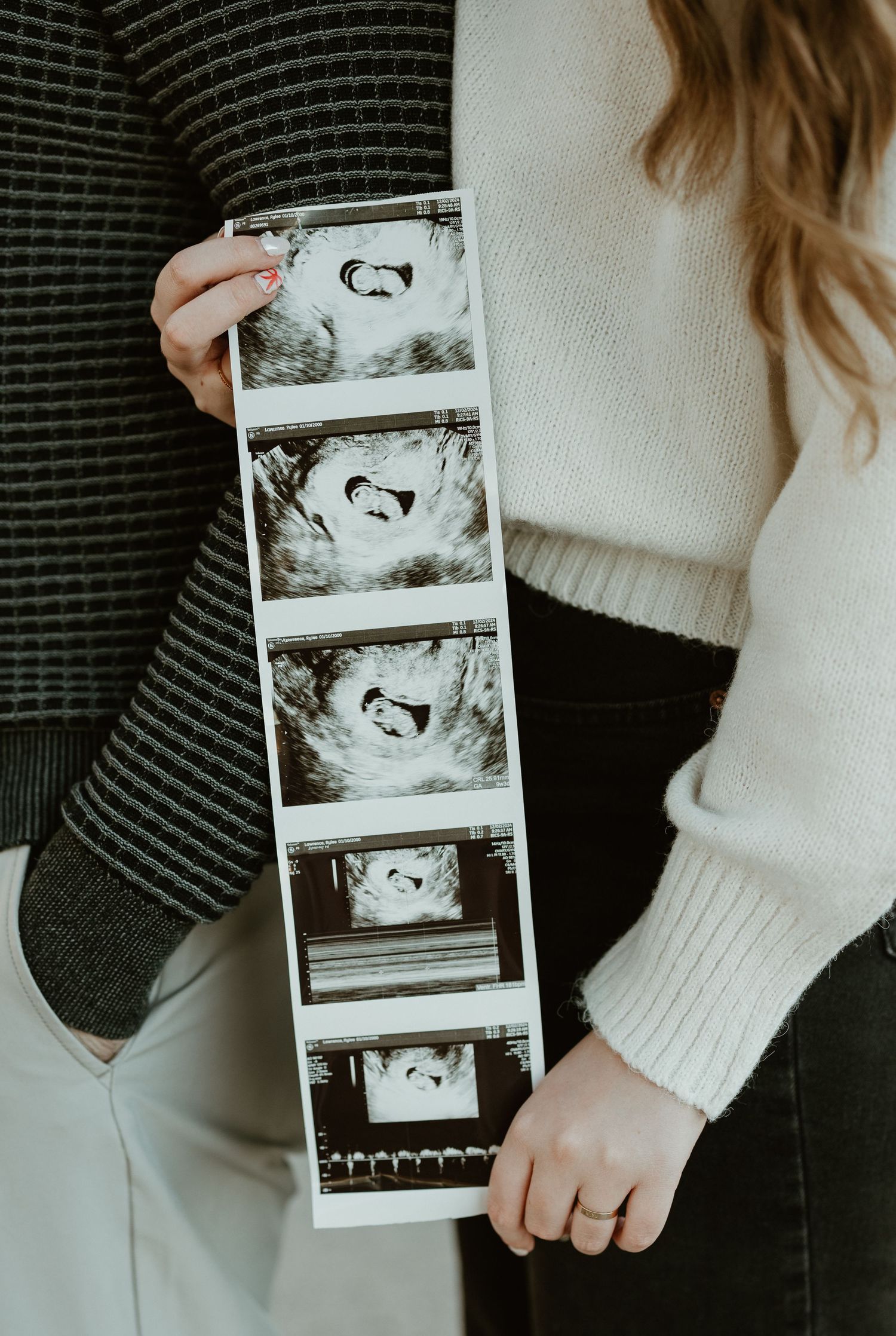 Someone holding a strip of ultrasound photos while wearing a striped sweater.