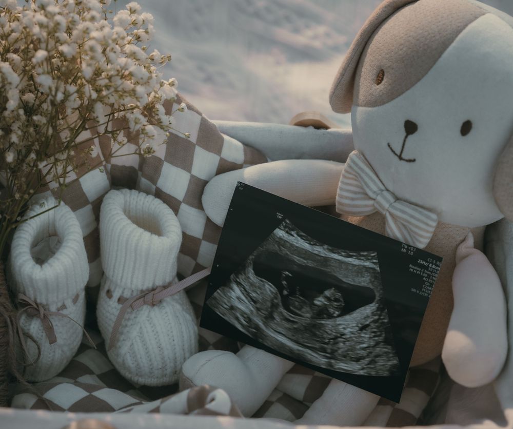 Baby booties and plush bunny toy placed next to ultrasound photo on checkered blanket in soft muted lighting.