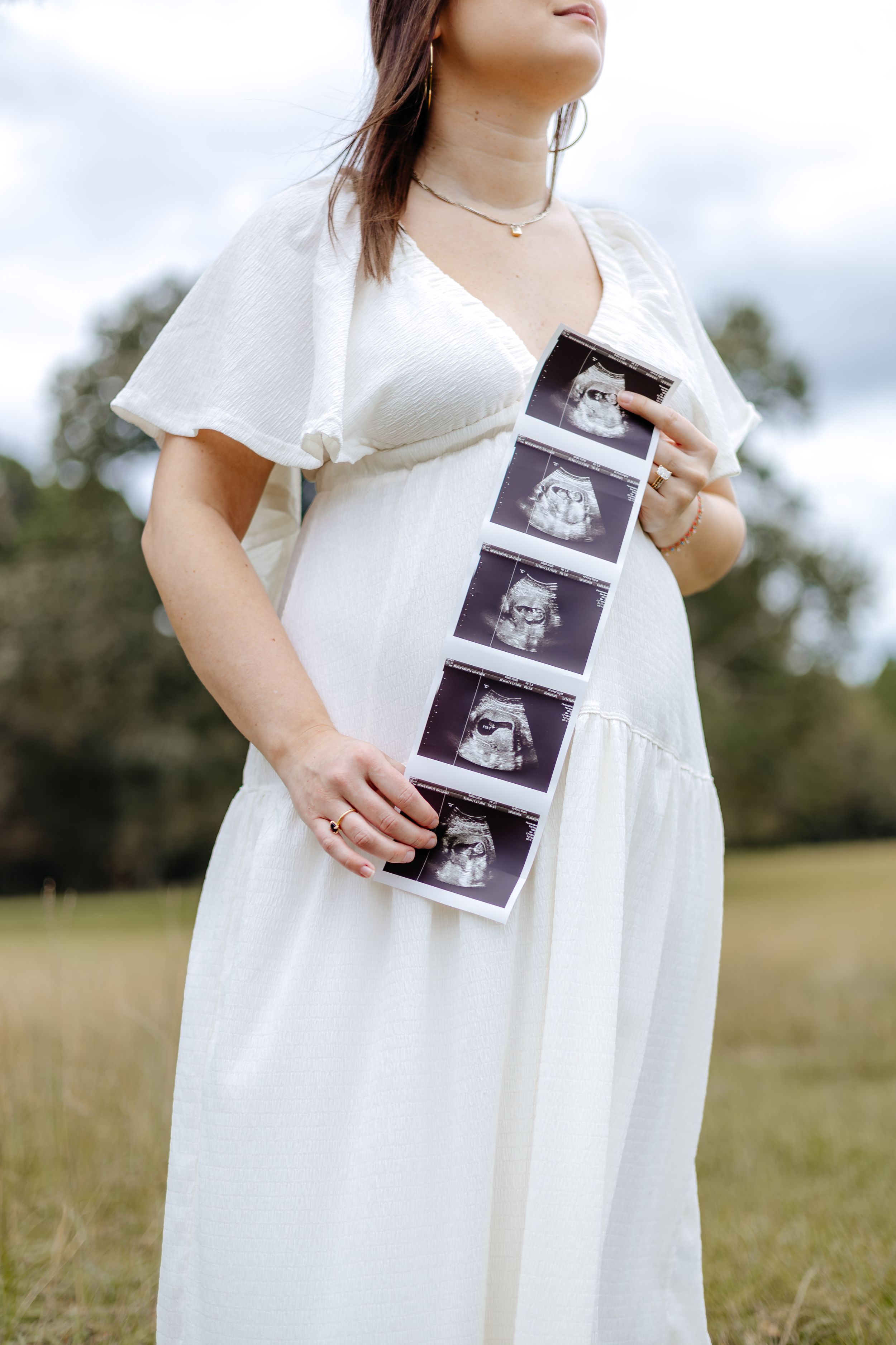 Woman in white dress holding ultrasound photos while standing in a grassy field.