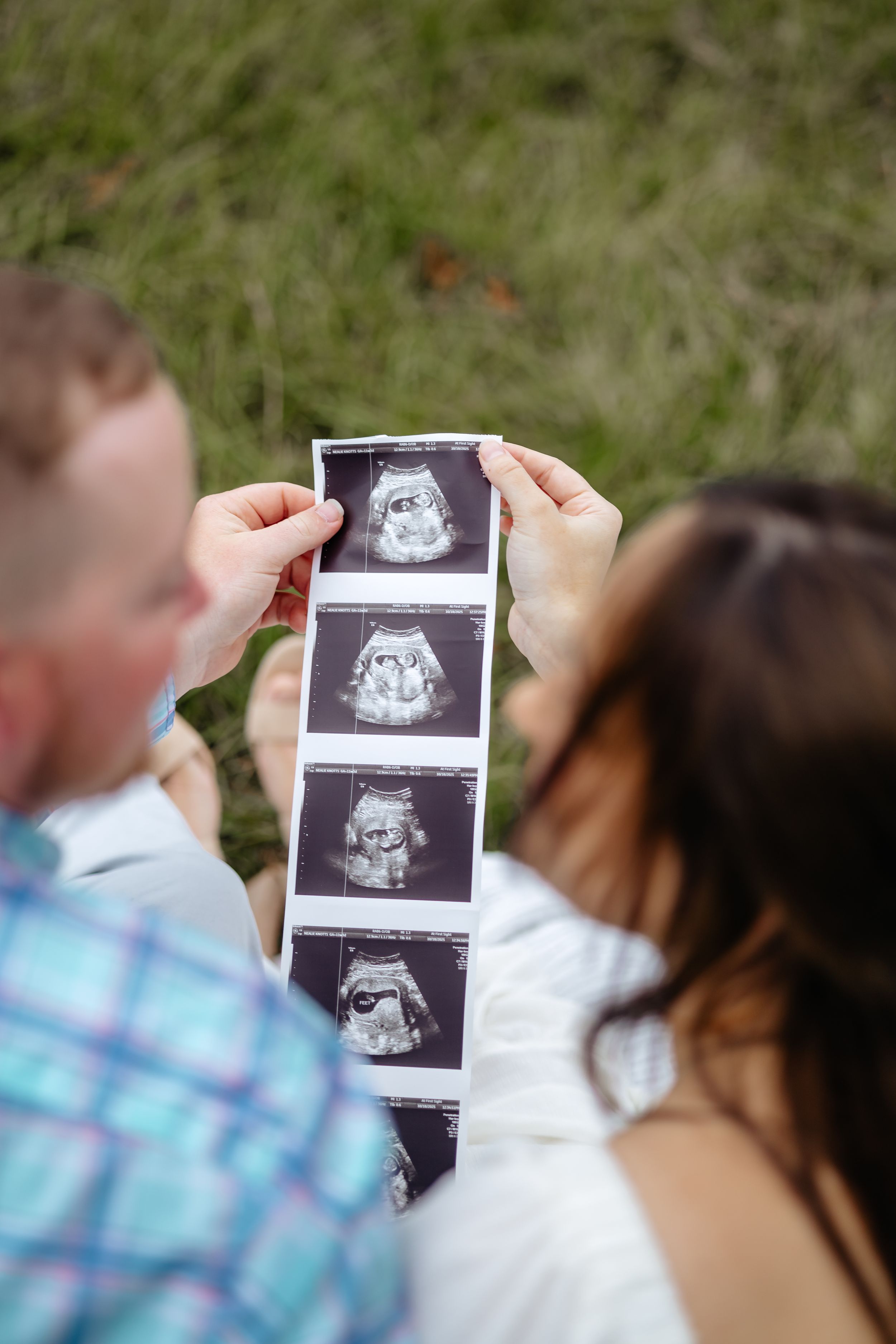Close-up view of ultrasound photos being held outdoors against a blurred natural background.