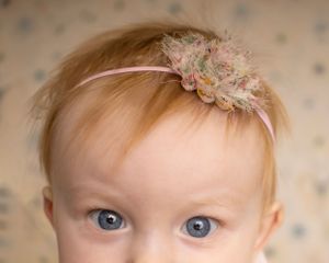 A close up image of the top of a baby's head and eyes