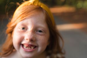 Smiling red-haired girl with freckles and missing teeth wearing a yellow headband.