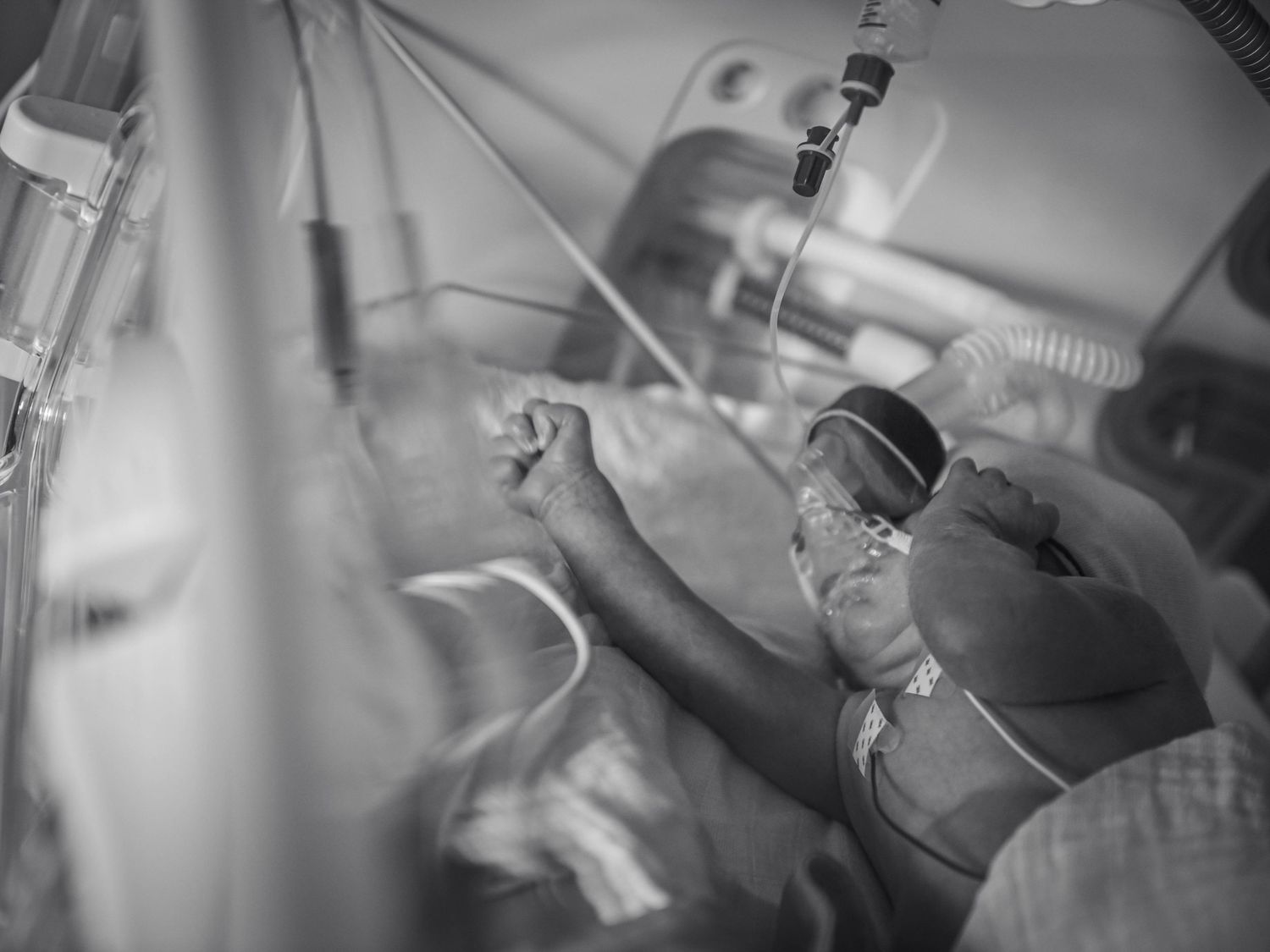 Black and white photo of premature newborn baby in NICU incubator with medical equipment and tubes.