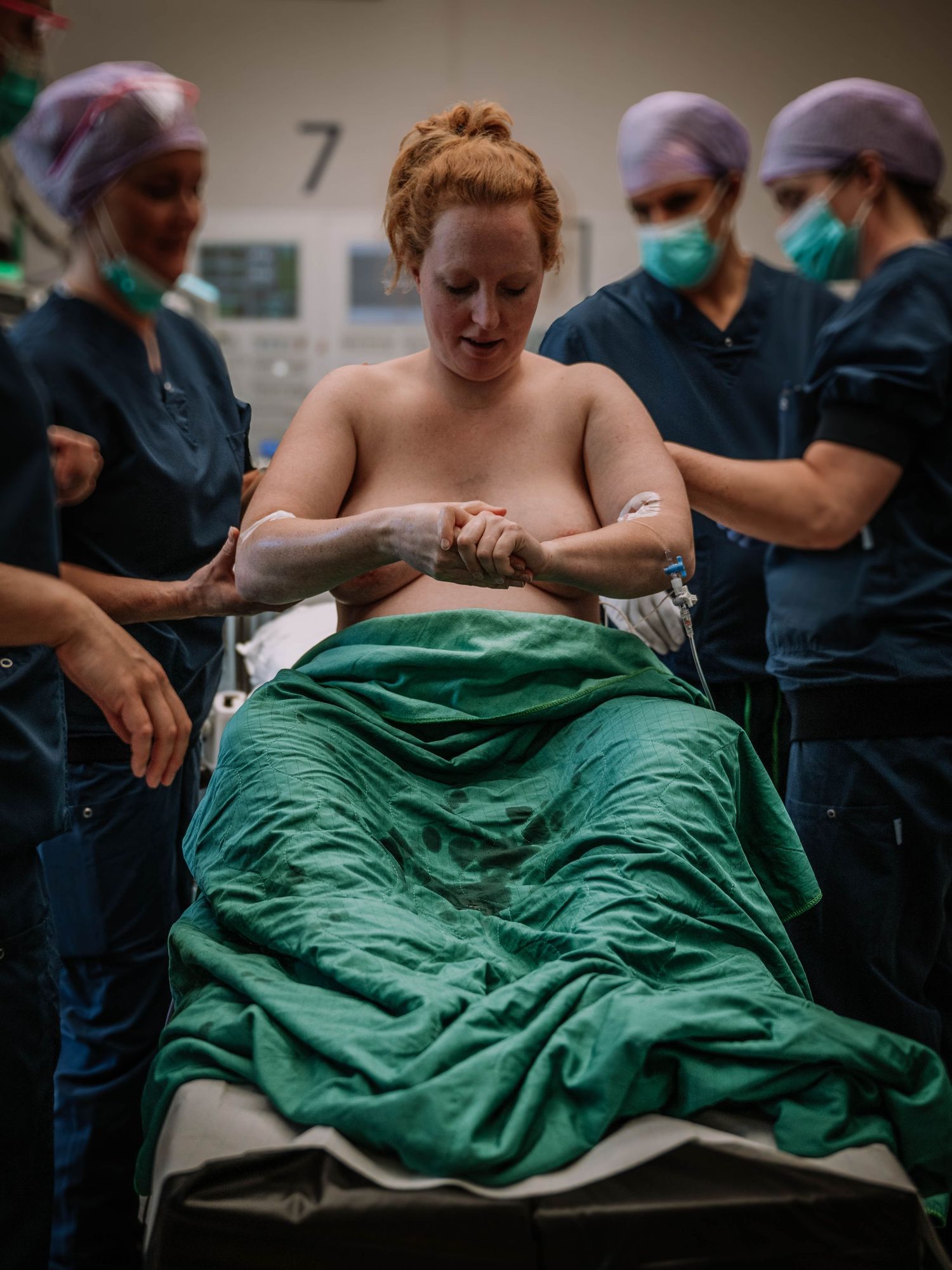 A woman in a hospital operating room surrounded by medical staff in scrubs during a cesarean section procedure.