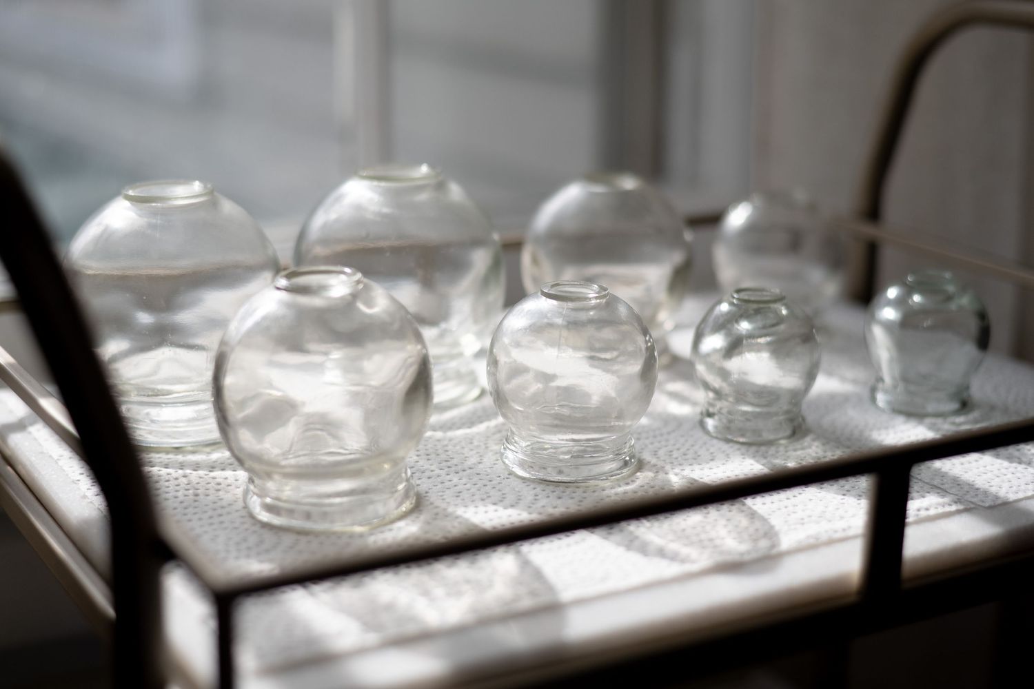 Several empty glass cupping therapy jars arranged on a metal tray in a medical setting.