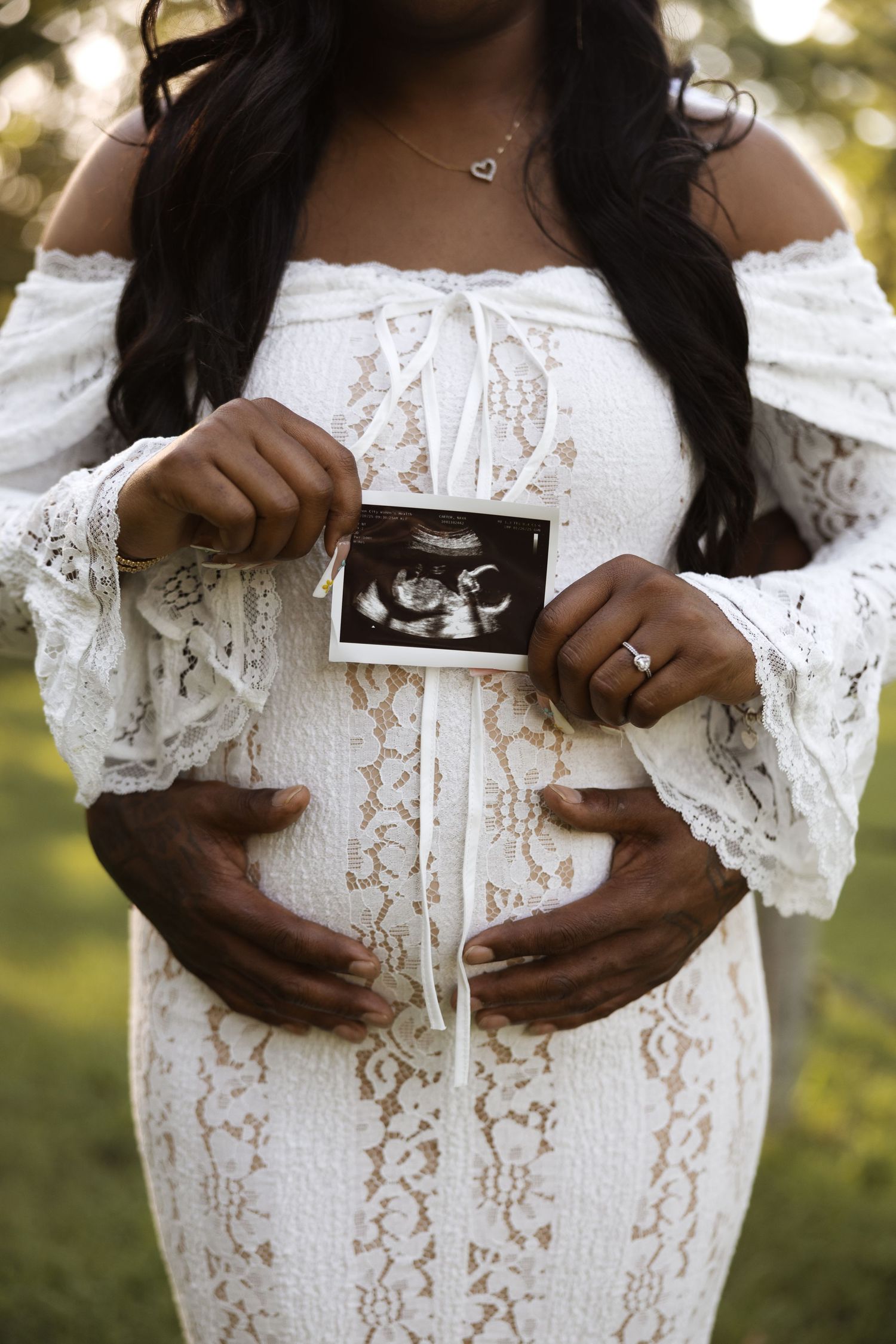 Pregnant woman in white lace dress holds ultrasound photos against her belly in sunlit garden.