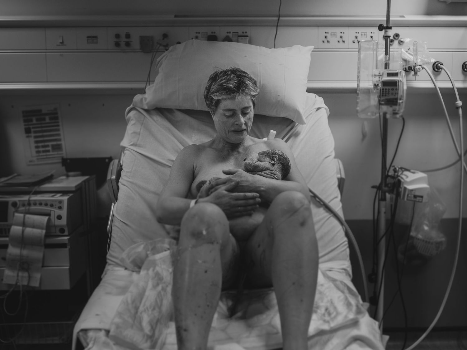 A mother holding her newborn baby for the first time, moments after birth, with blood and vernix still visible —birth photographer beckenham