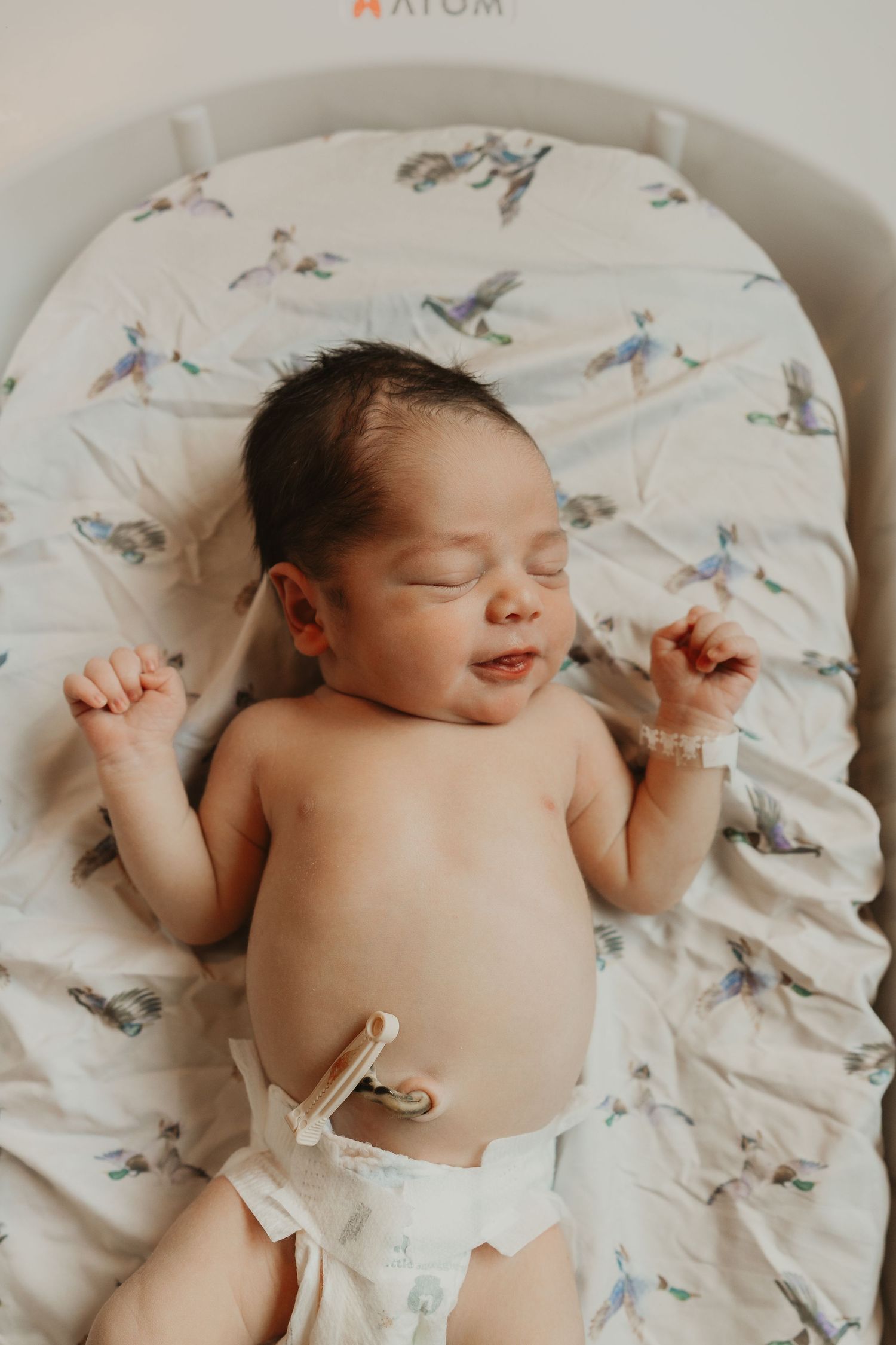 Newborn baby sleeping peacefully in a bird-print bassinet, wearing a diaper with umbilical cord clamp visible.