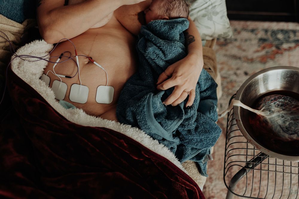 A woman rests after birth with a tens on her tummy to help ease her after birth pains. A baby is nestled in her arm