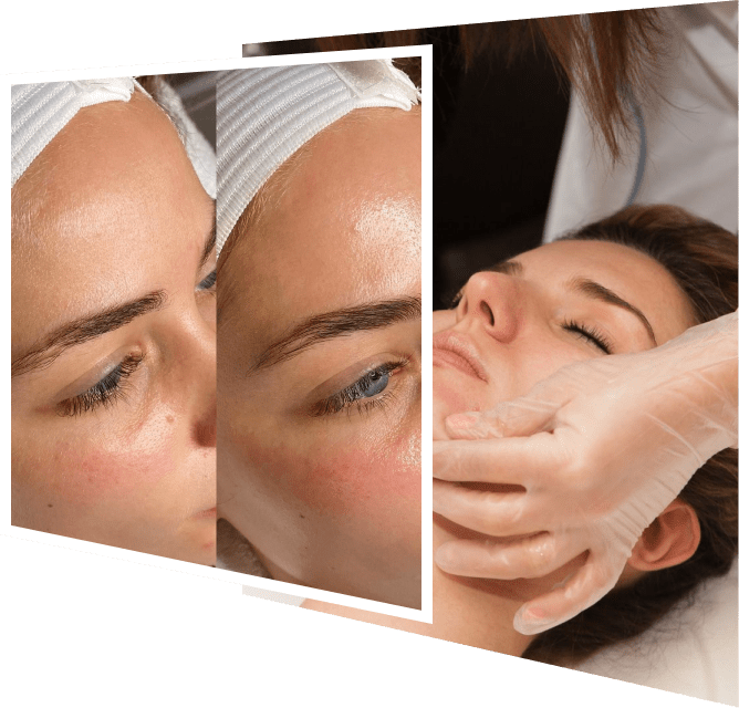 HydraFacial in Dubai