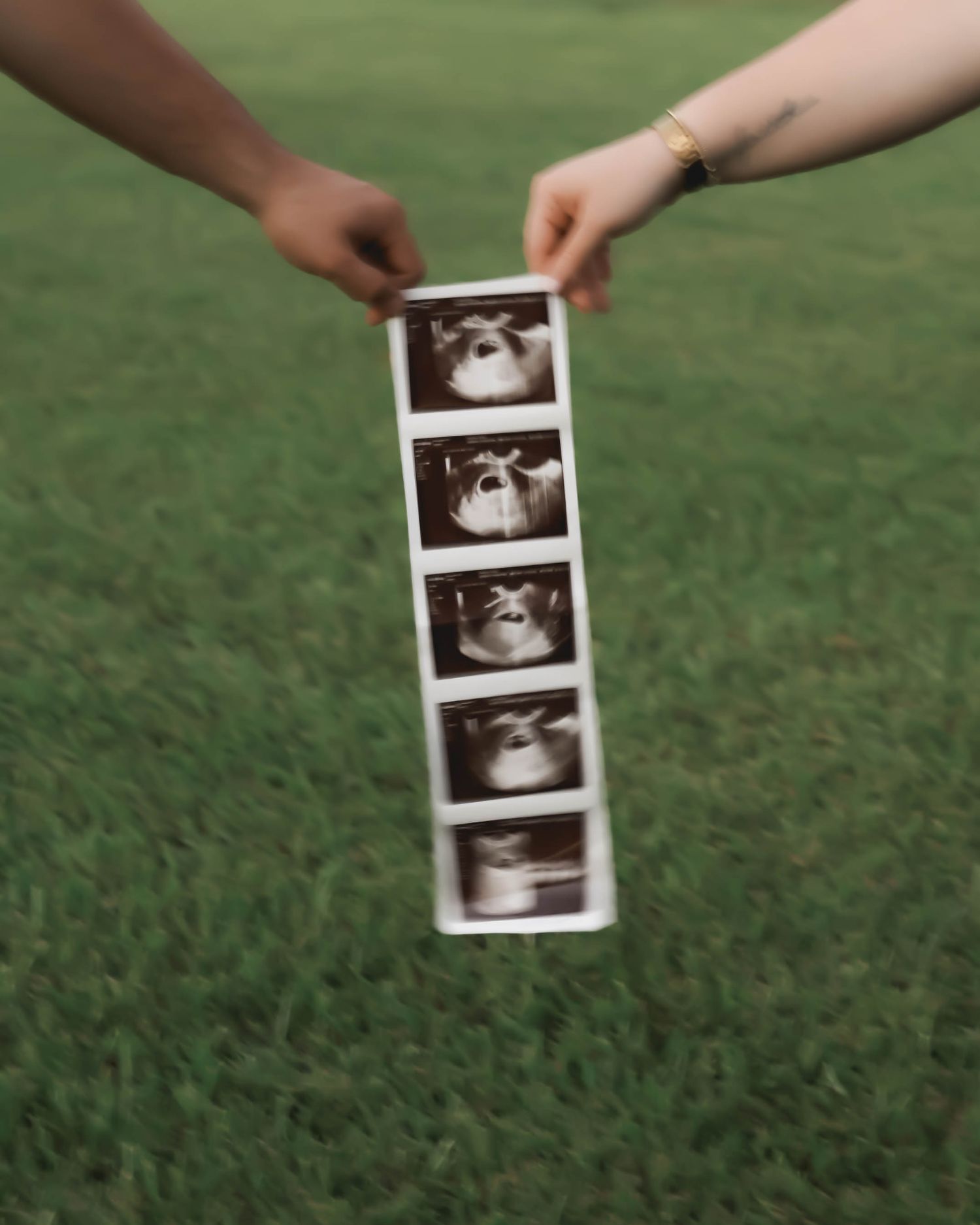 Hands holding ultrasound photo strip against green grass background.