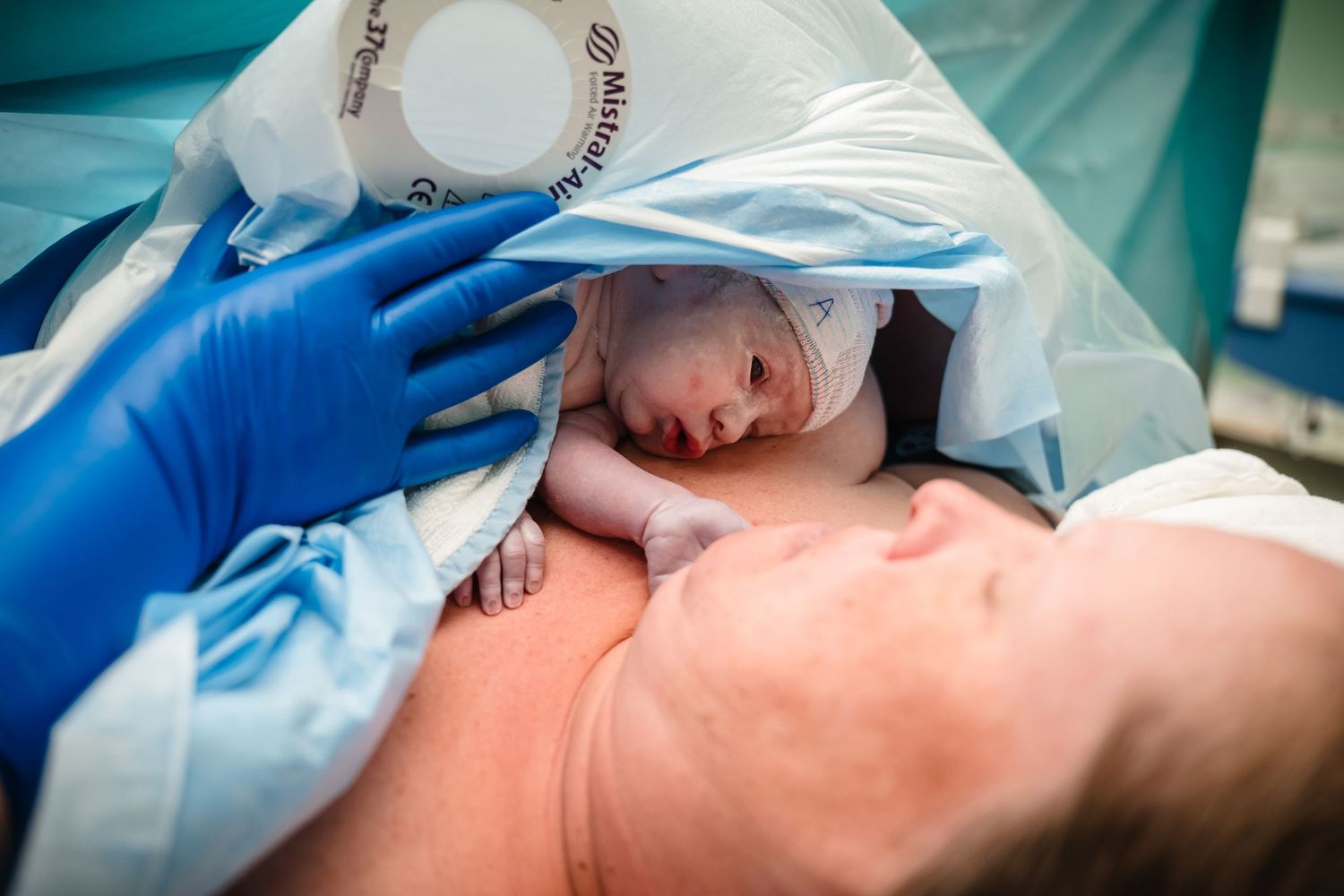 Als de baby geboren is tijdens de keizersnede mag het vaak op de borst liggen. Dat zie je ook in deze foto.