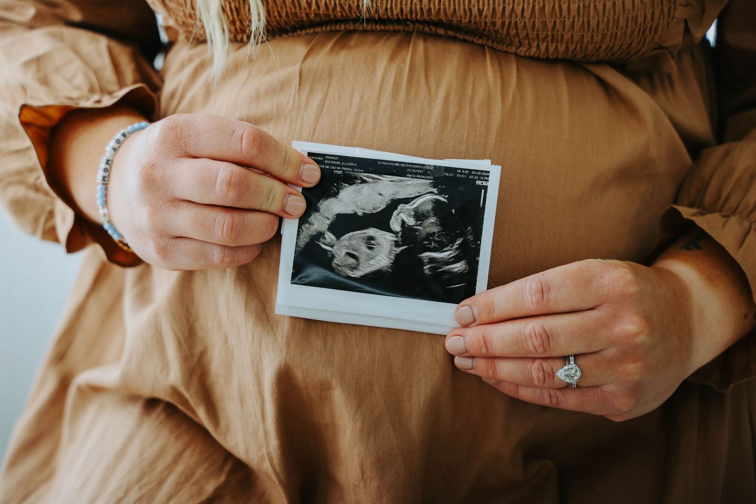 Close-up of hands holding ultrasound photo while wearing brown dress.