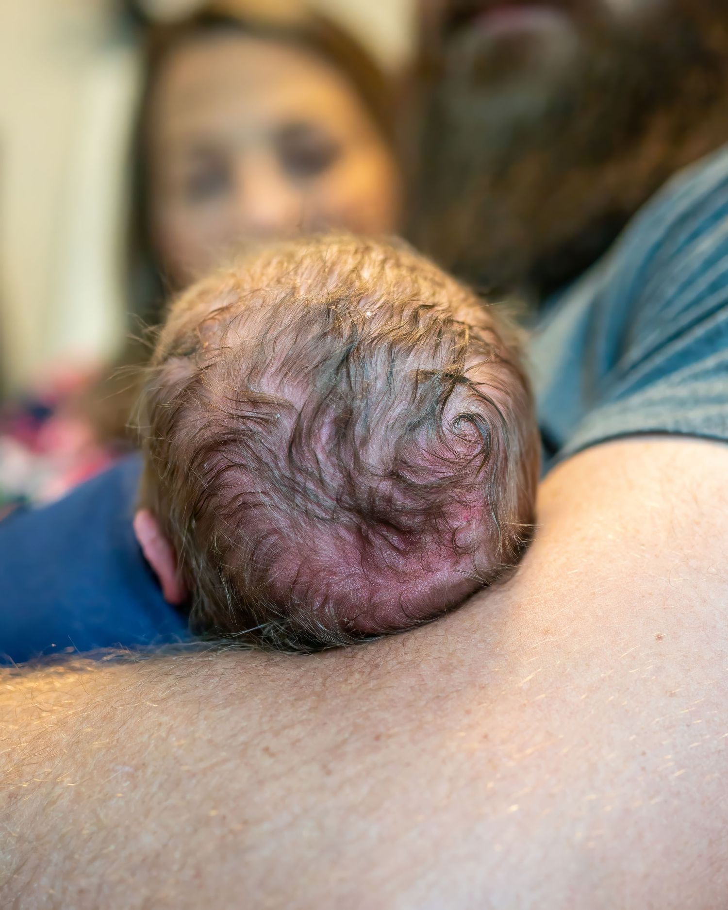 Close-up view of a newborn baby's head showing swirled hair pattern.