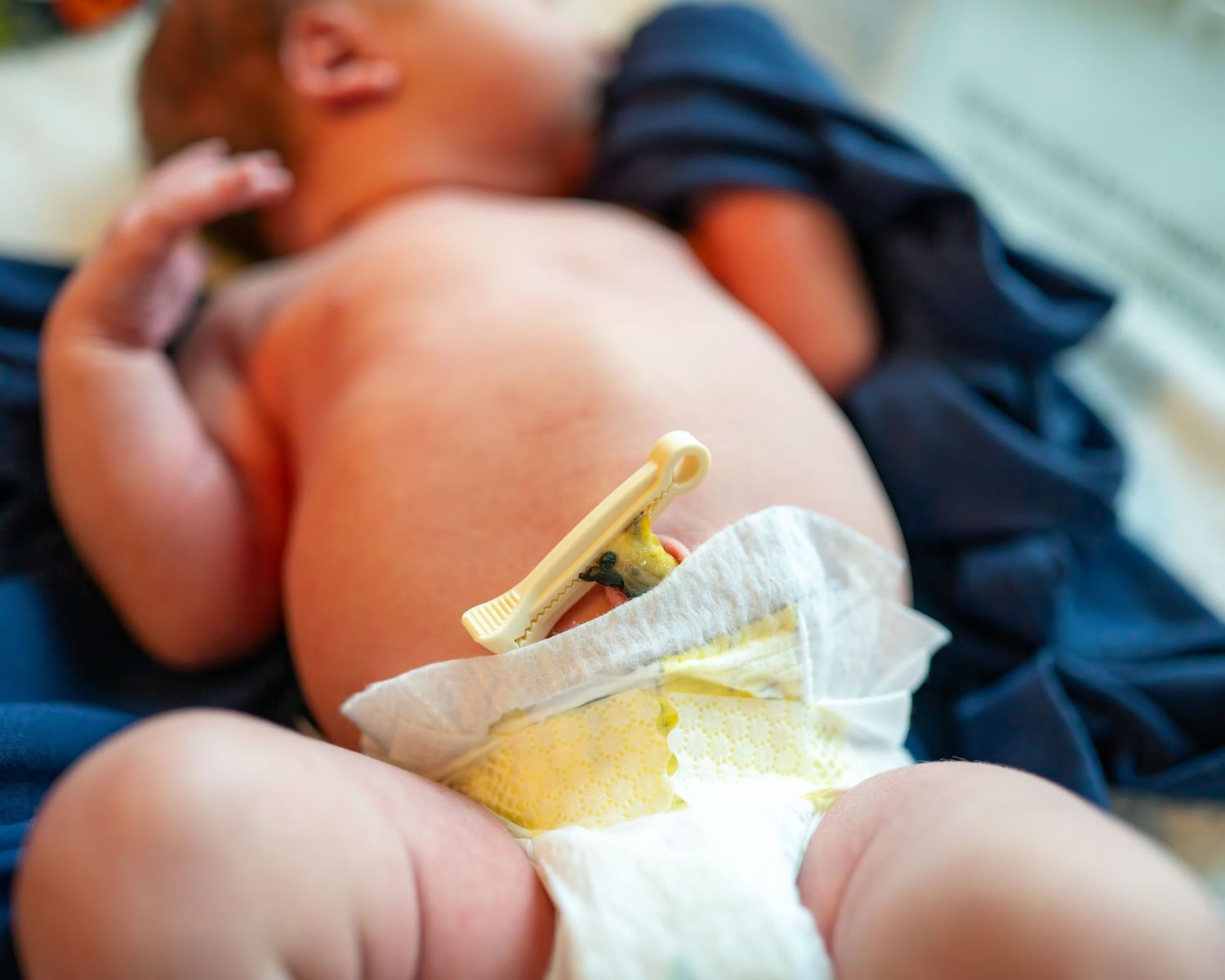 Close-up of newborn baby's belly with hospital ID bracelet and diaper.