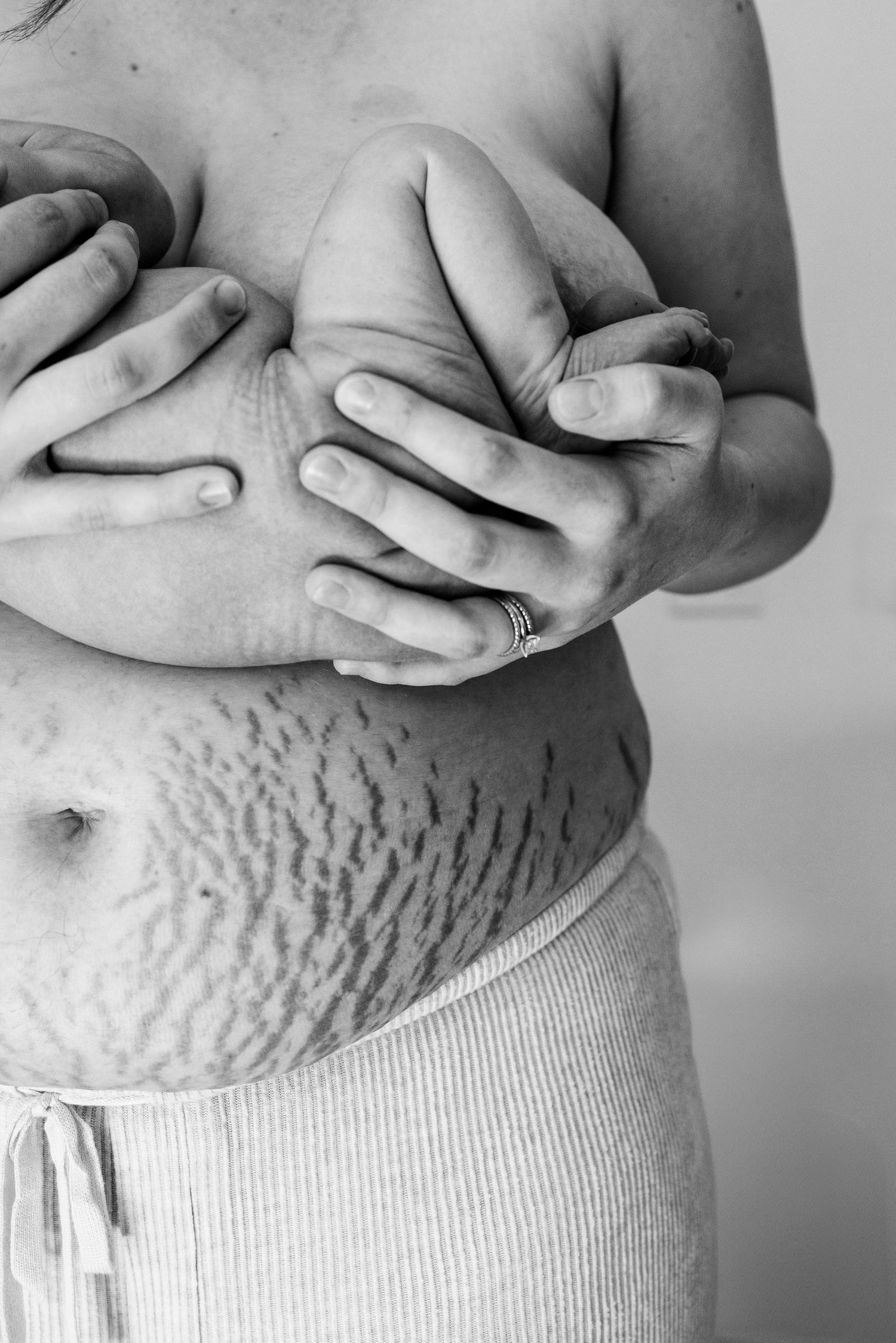 Black and white photo of postpartum woman showing stretch marks on abdomen, hands covering chest, wearing ribbed waistband bottoms.