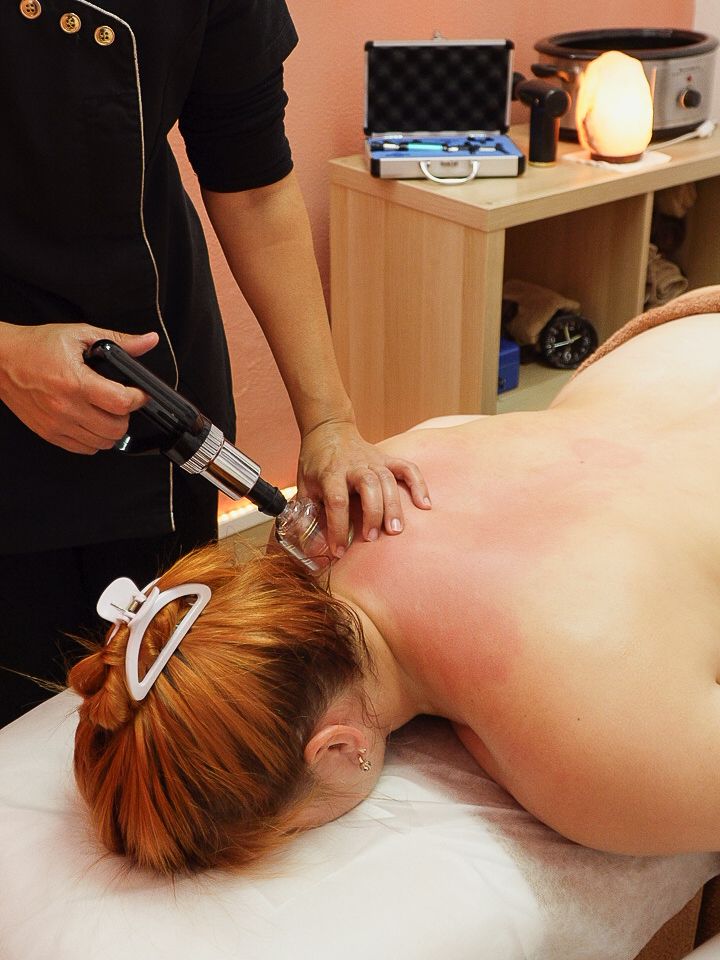 Therapist performing cupping massage treatment on client's upper back and neck area.