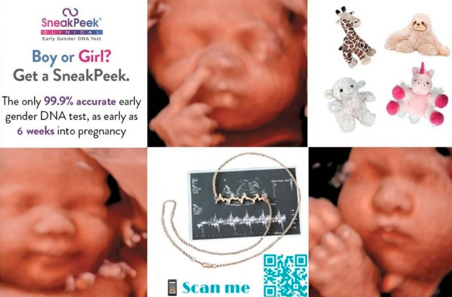 Medical ultrasound collage showing fetal scans and pregnancy-related images with pink and blue color accents.