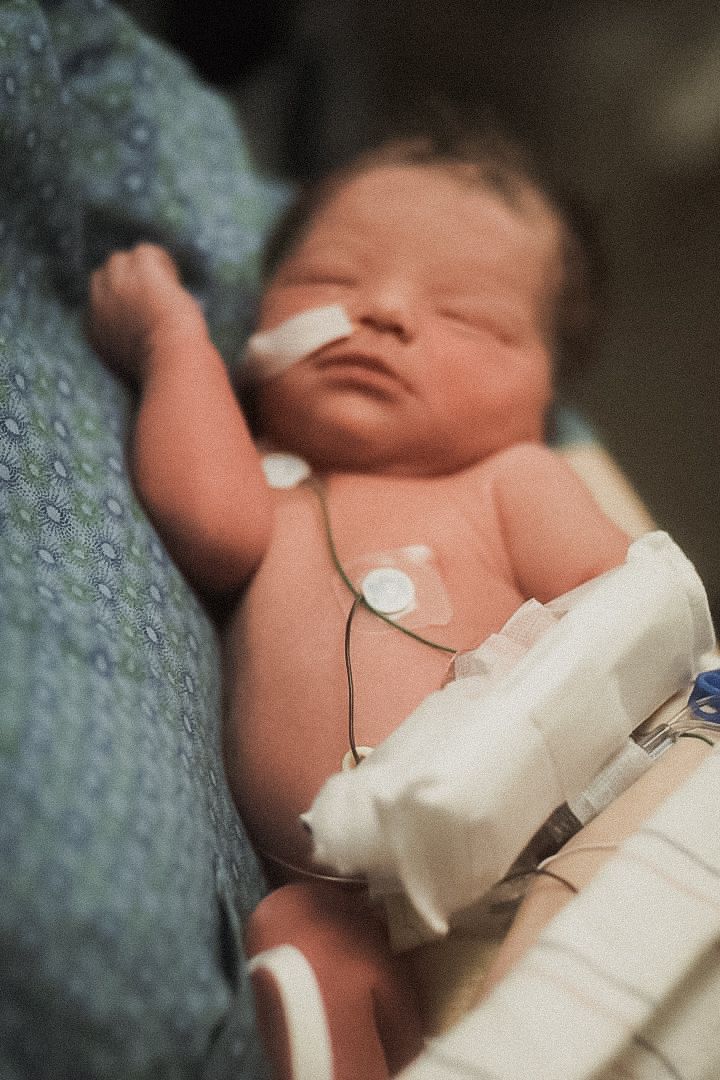 Close-up images of a newborn baby with medical monitoring equipment.