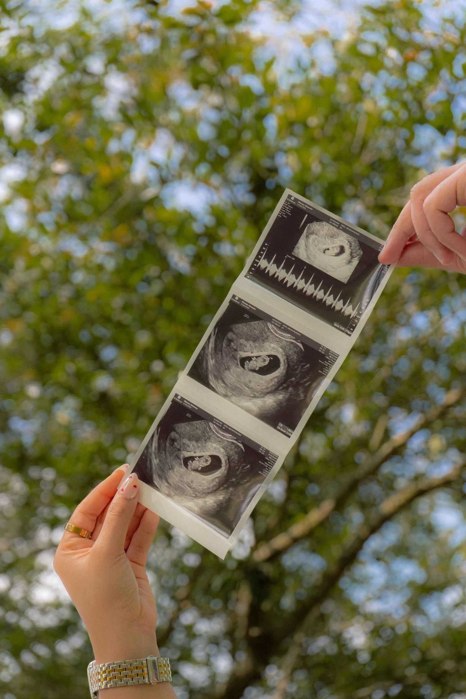 Two hands holding ultrasound photos of a baby against a green tree background outdoors.
