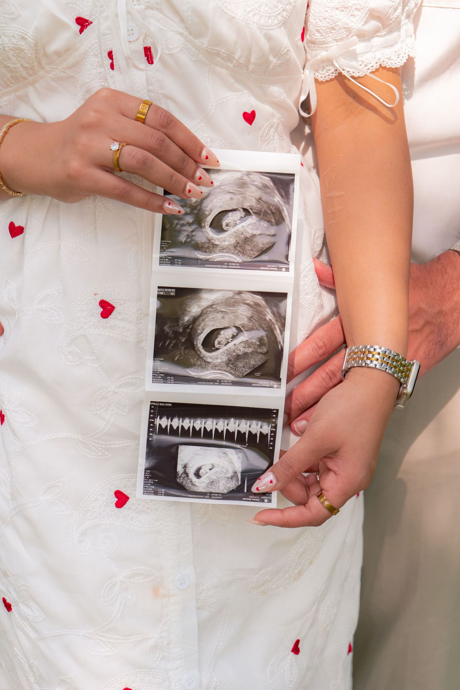 Pregnant woman in white heart-print dress holding ultrasound photos with partner's hand on her back.
