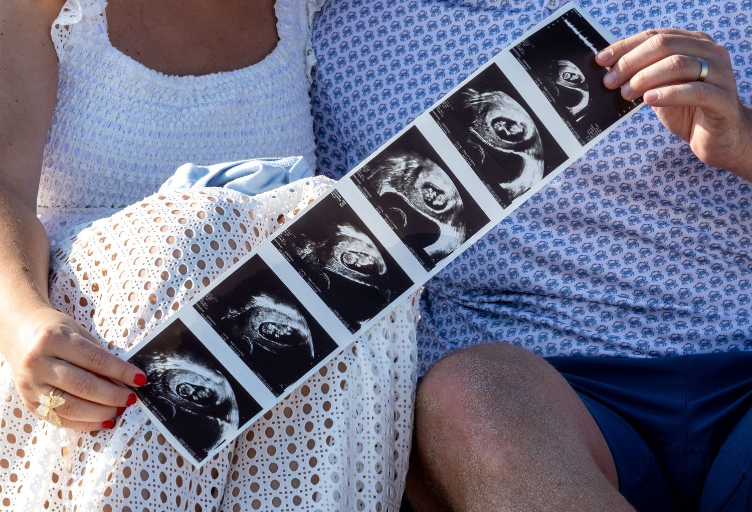 Couple holding ultrasound photos outdoors, pregnancy announcement with multiple sonogram images.