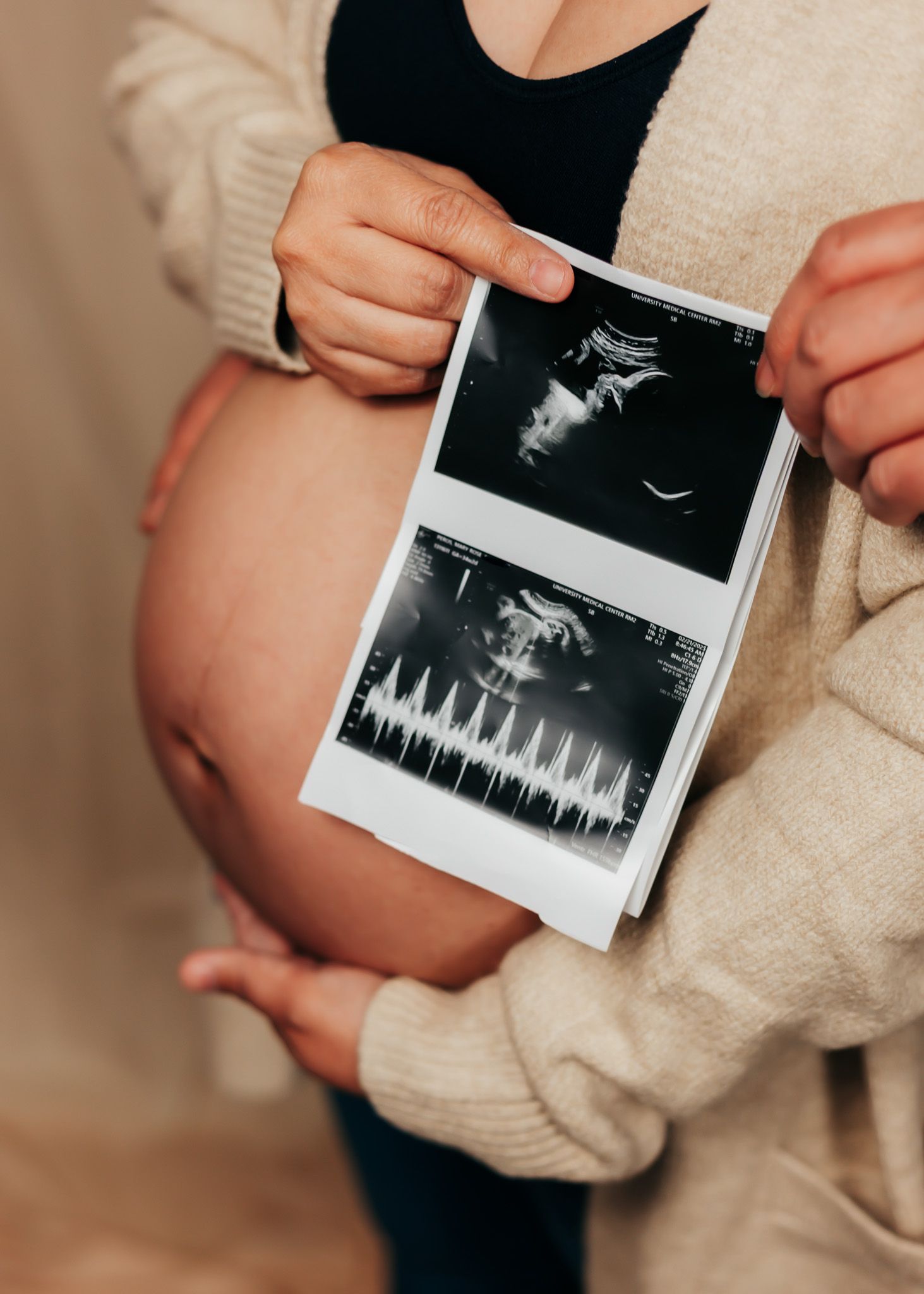 A collection of ultrasound images being held in hands with a knitted cream sweater, showing different stages of pregnancy development.