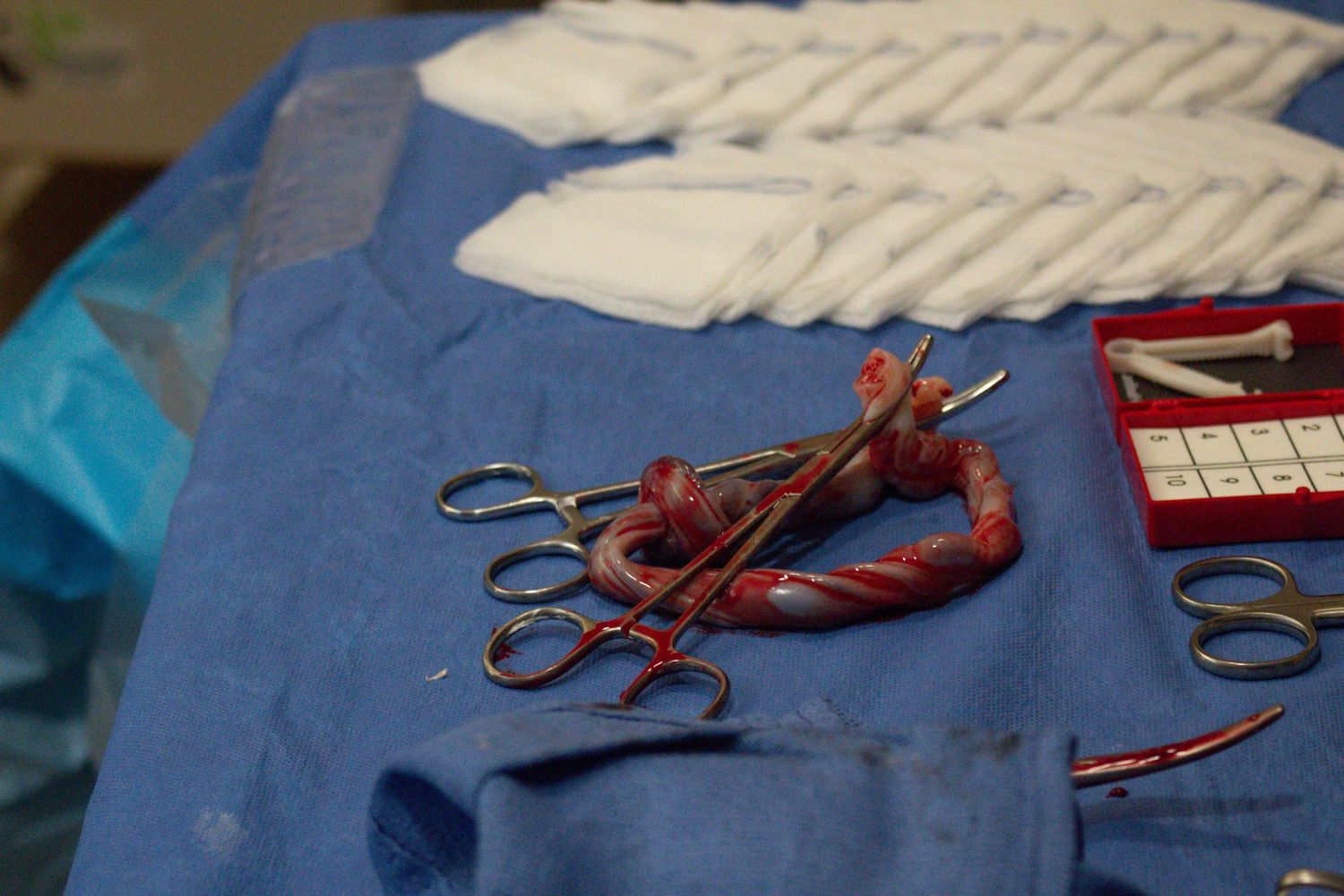 Medical instruments and tools arranged on blue surgical draping.