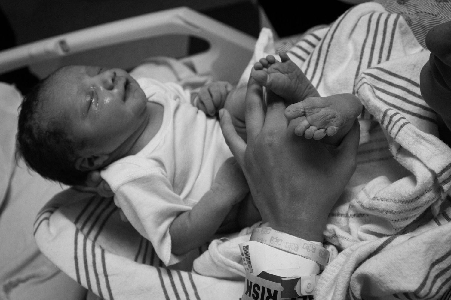 Black and white image of newborn in striped blanket during medical care.