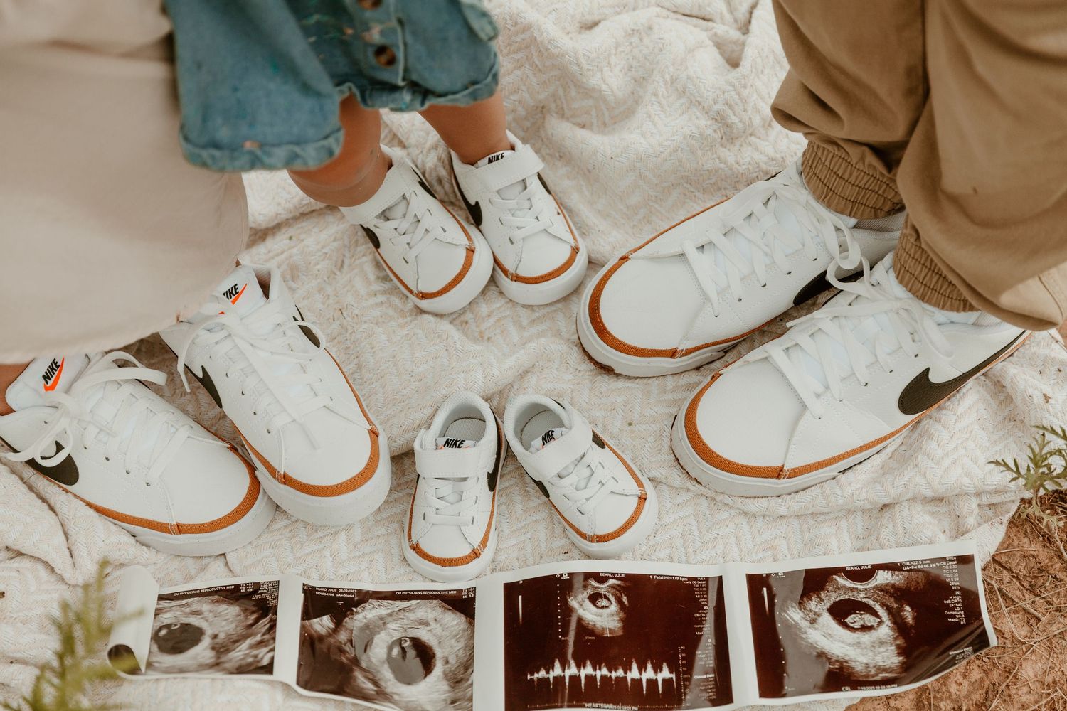 Several pairs of white sneakers with brown soles arranged on ultrasound photos on a light surface.