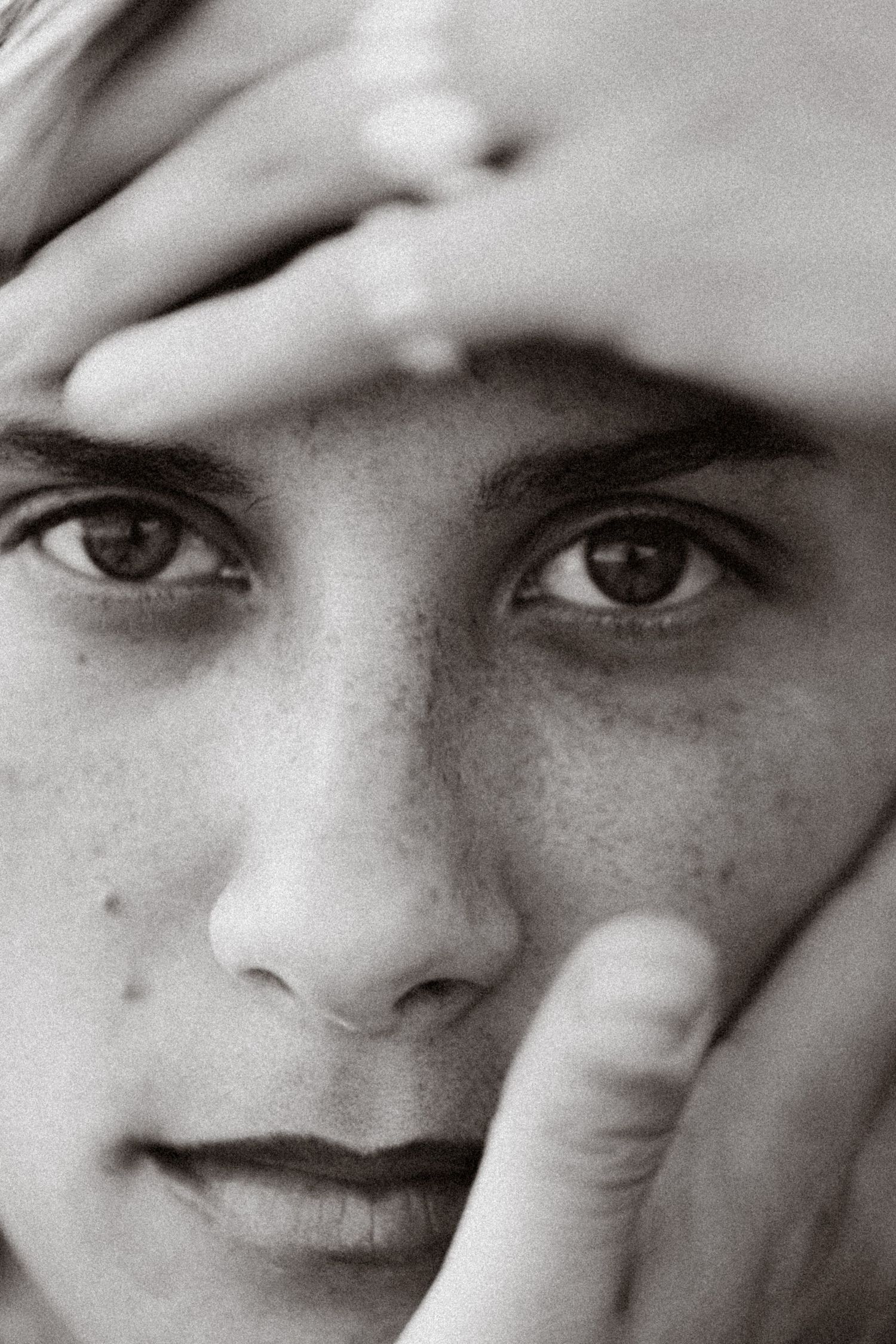 Black and white close-up portrait of a young person with freckles, hands framing their expressive face.