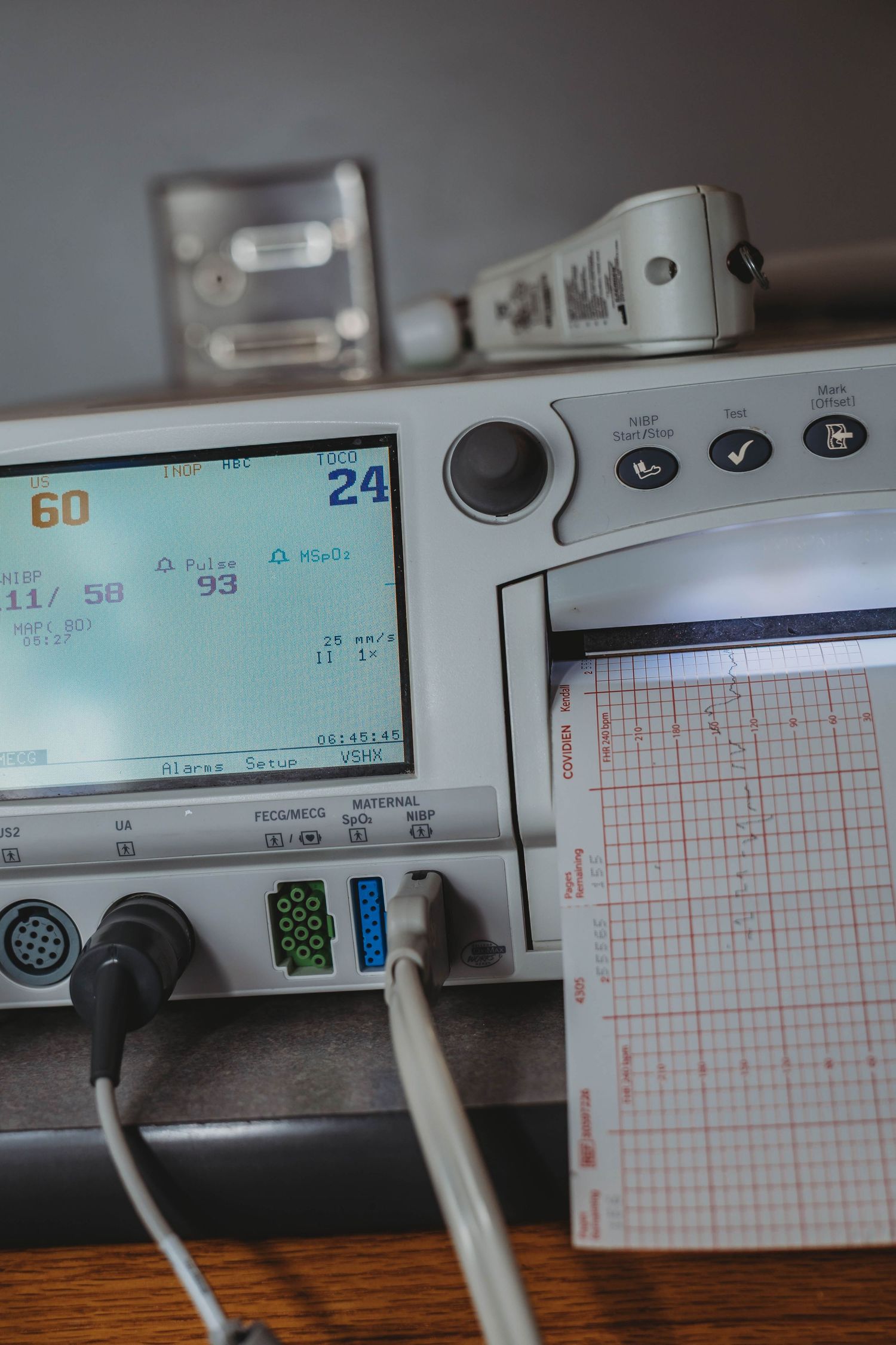 Close-up of a medical fetal and maternal monitor displaying vital signs with attached cables and a printed paper strip of readings.