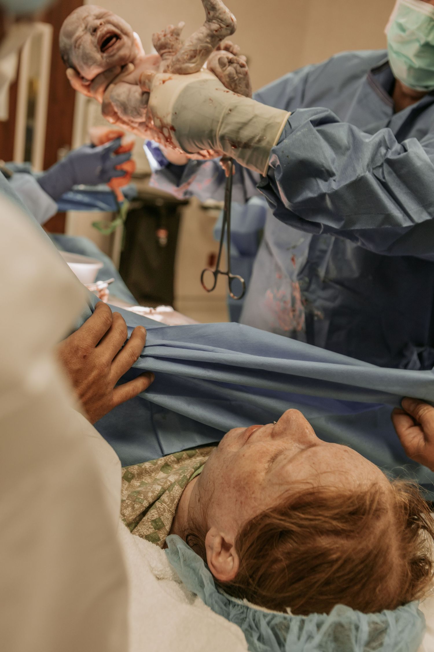 A newborn baby is held up by a doctor during a C-section delivery while the mother lies on the operating table.