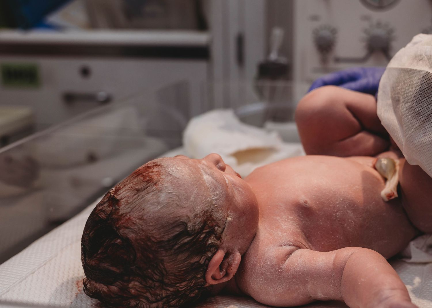 Newborn baby lying on a hospital bed moments after birth, with a wet, hair-covered head and umbilical cord still attached.