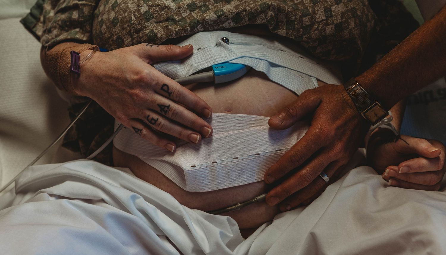 Pregnant woman in hospital bed with fetal monitor straps on belly, hands resting gently on bump.