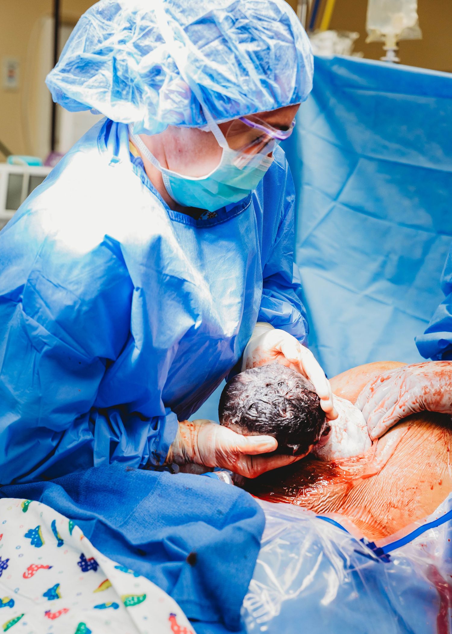 Medical professional in blue scrubs and gloves delivering a newborn baby in an operating room during a C-section.