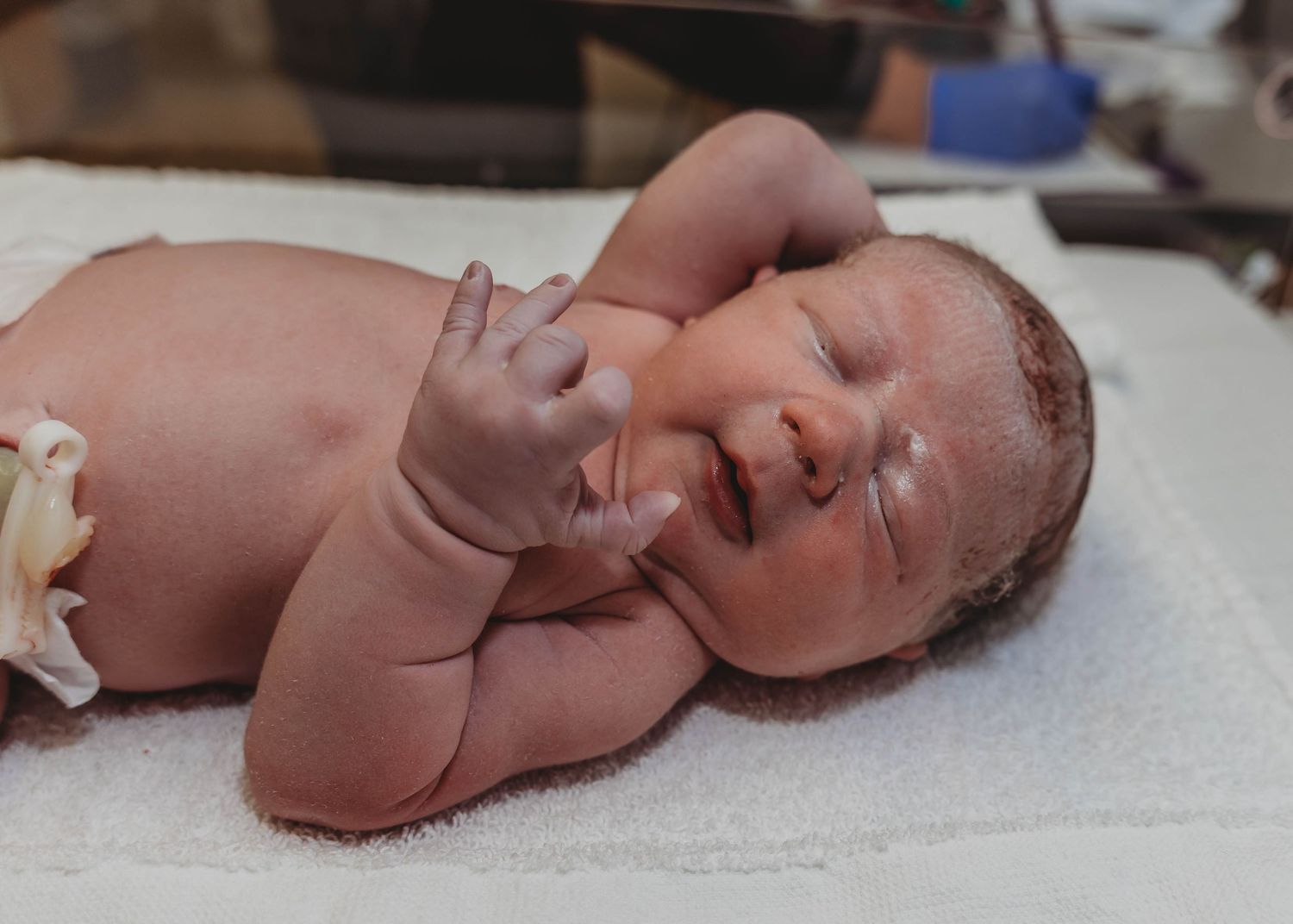 Newborn baby with vernix-covered skin lies on a white towel with one tiny hand raised near the face in a hospital delivery room.