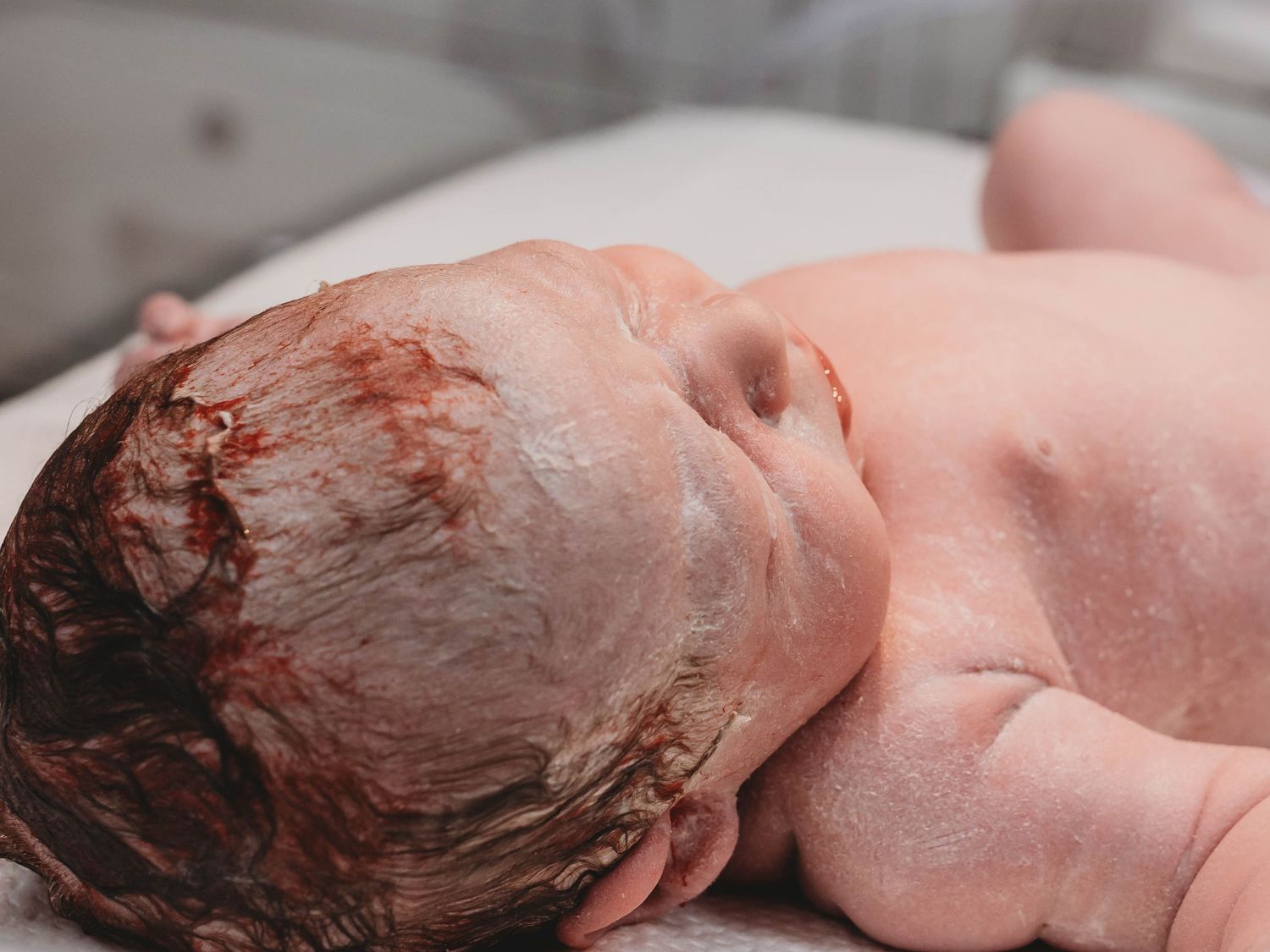 Newborn baby lying on a white sheet moments after birth, with blood-streaked hair and vernix on the skin.