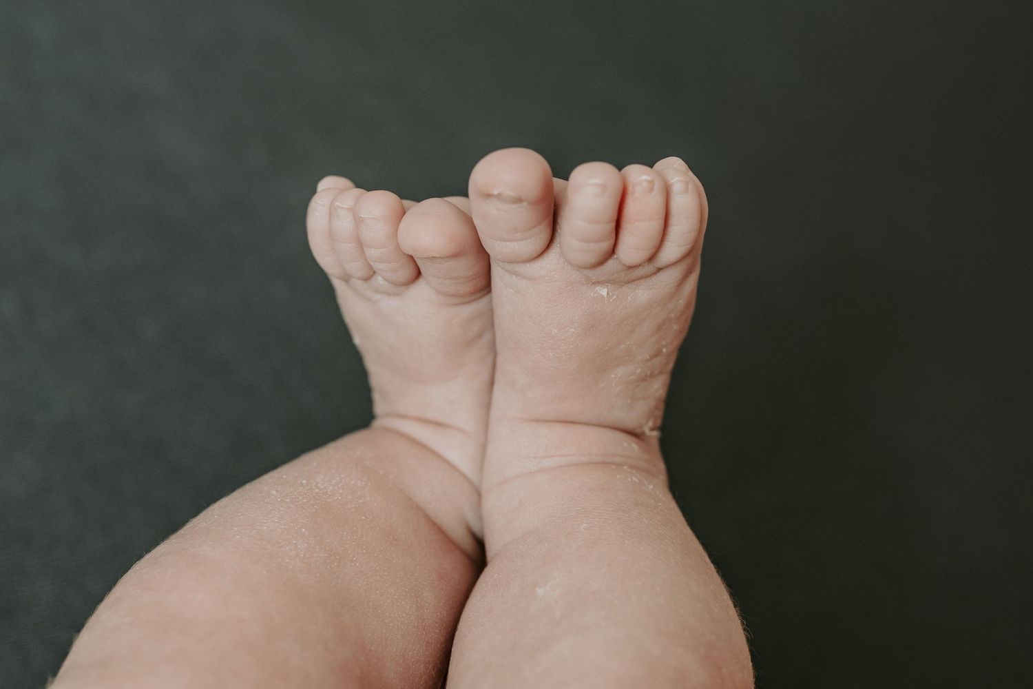 Close-up of tiny newborn baby feet and toes resting on a dark gray background.