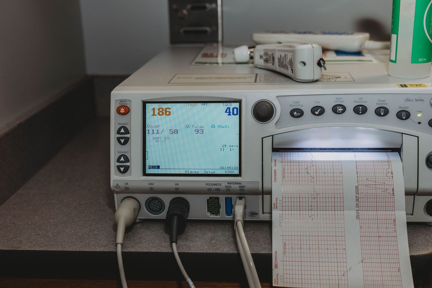Fetal heart rate monitor with digital display and printing paper strip, used for monitoring baby heartbeat and contractions during labor.