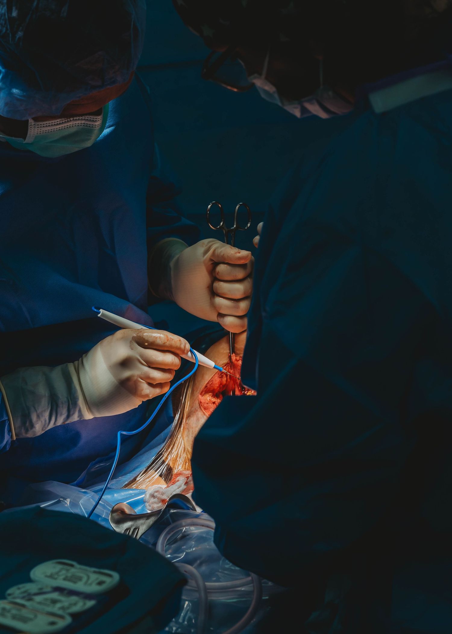 Surgeons in masks, caps and gloves operate under dim blue light, holding forceps and a surgical instrument over an open incision.