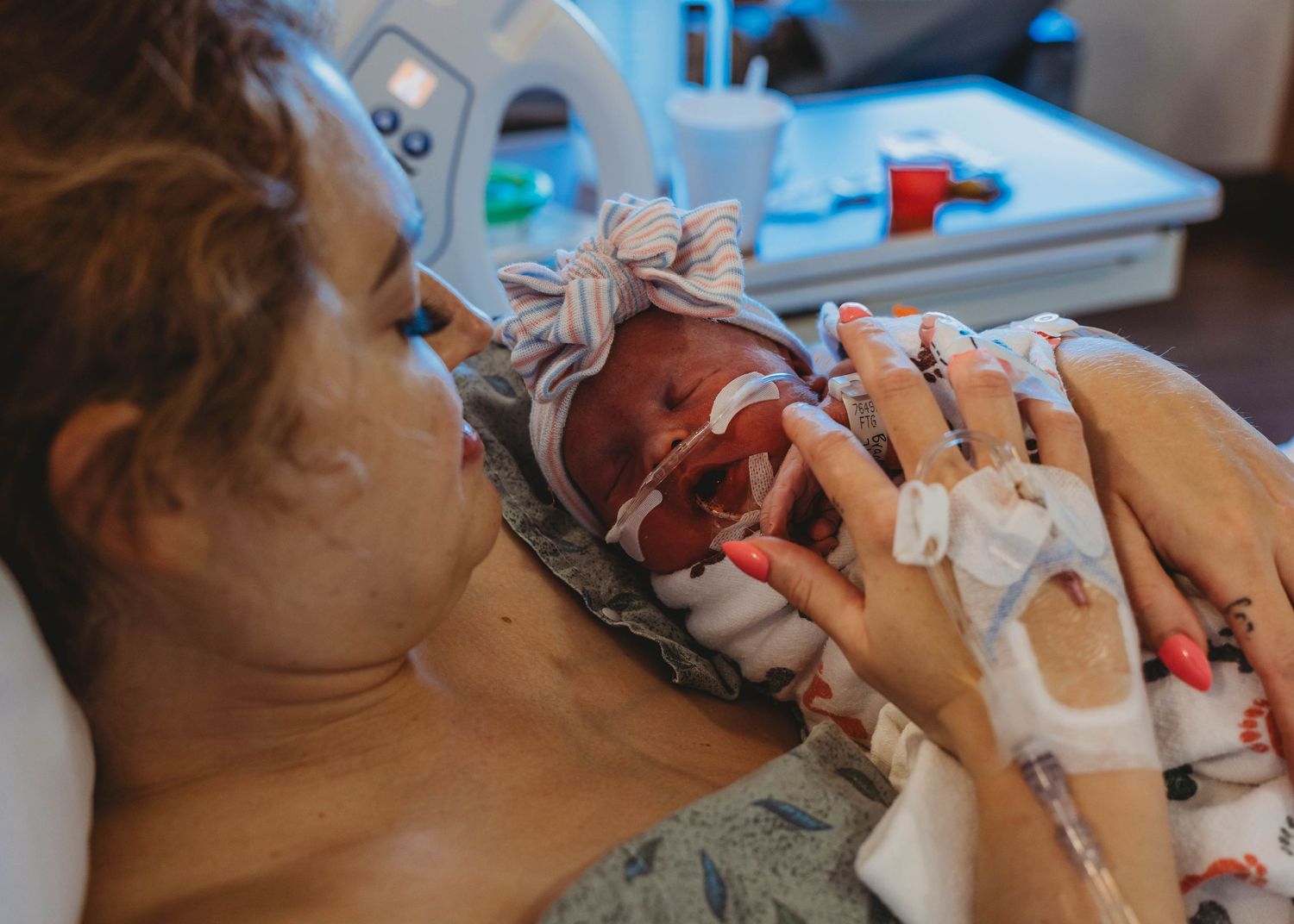 Mother doing skin-to-skin kangaroo care with premature newborn wearing breathing tube directly after birth in a hospital postpartum room.
