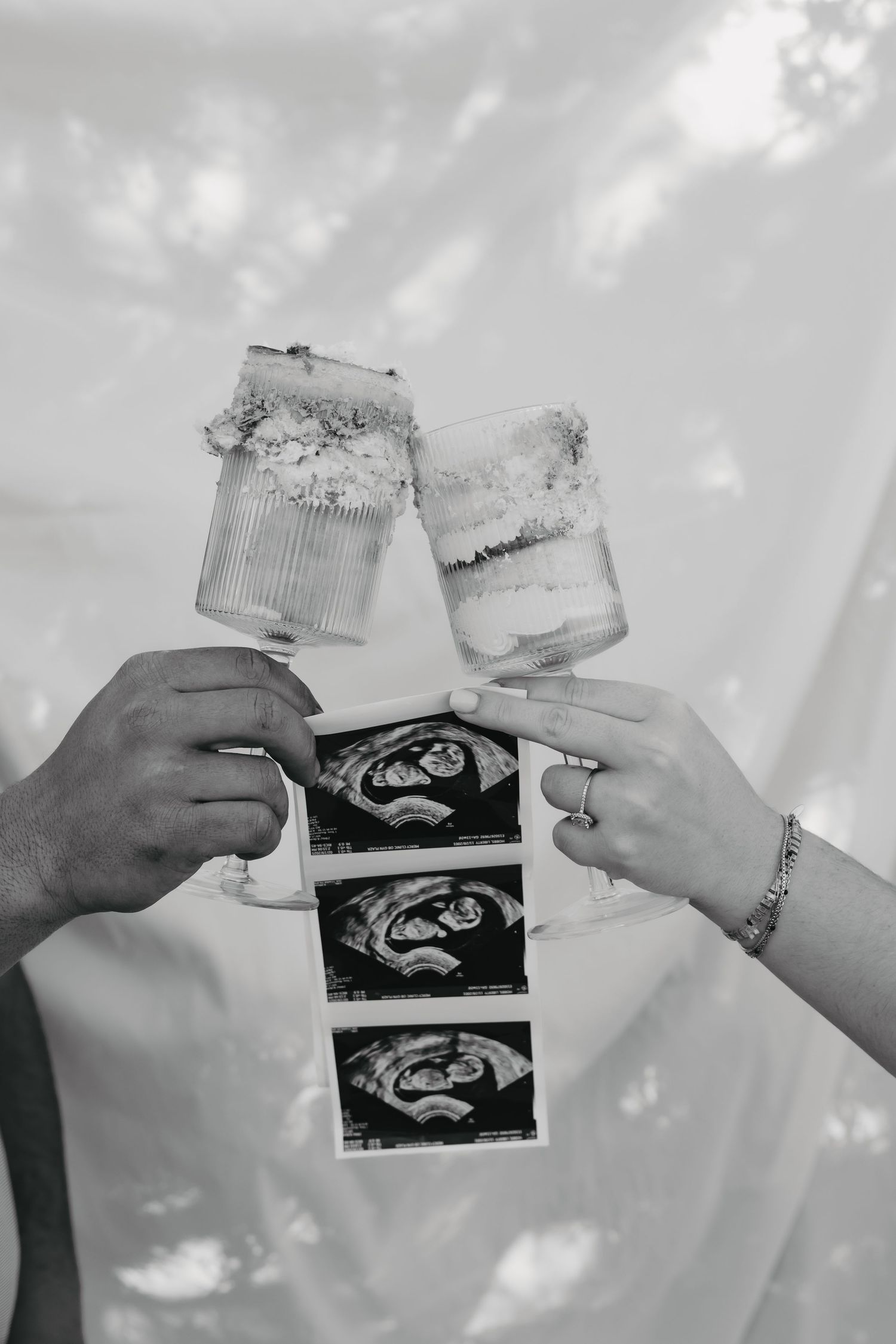 Hands toasting glasses over ultrasound images in black and white photography.