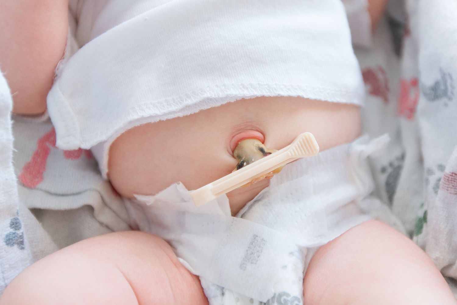 Newborn detail image during Fresh 48 session in Beaumont hospital.