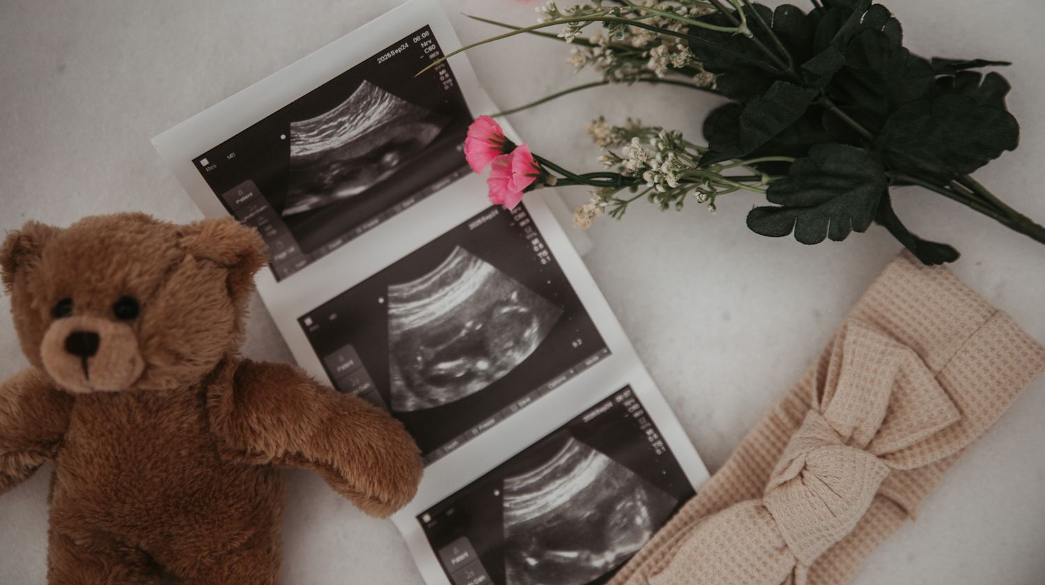 Baby announcement display with ultrasound photos, teddy bear, and neutral-colored decorative items arranged on white surface.