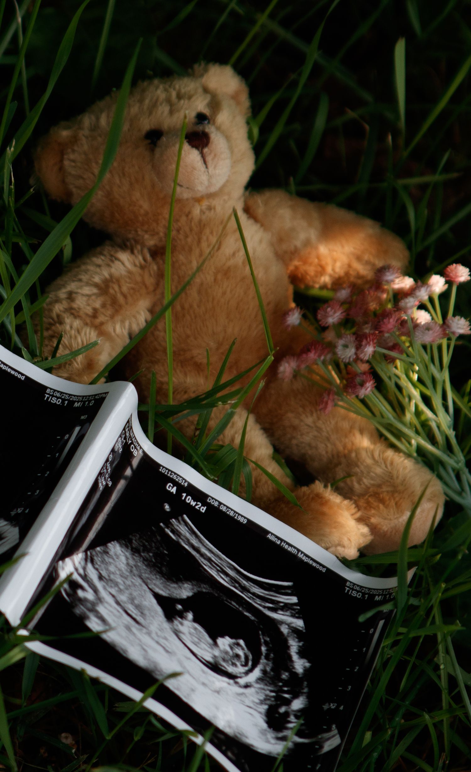 Ultrasound photos arranged with teddy bear and pink flowers in green grass.