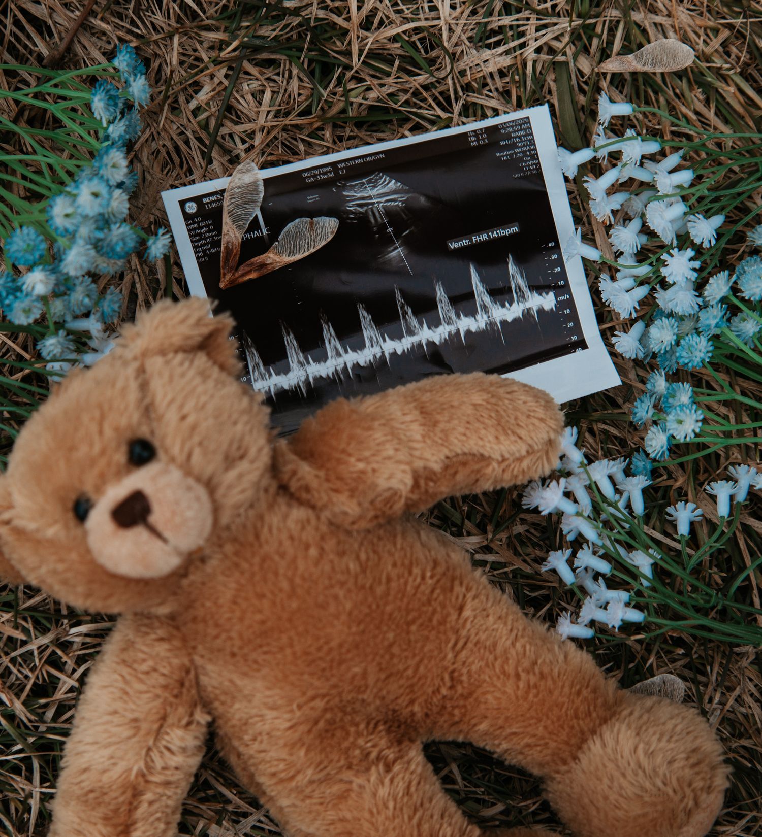 Brown teddy bear with ultrasound photos and blue flowers on grass, a heartfelt pregnancy announcement keepsake.
